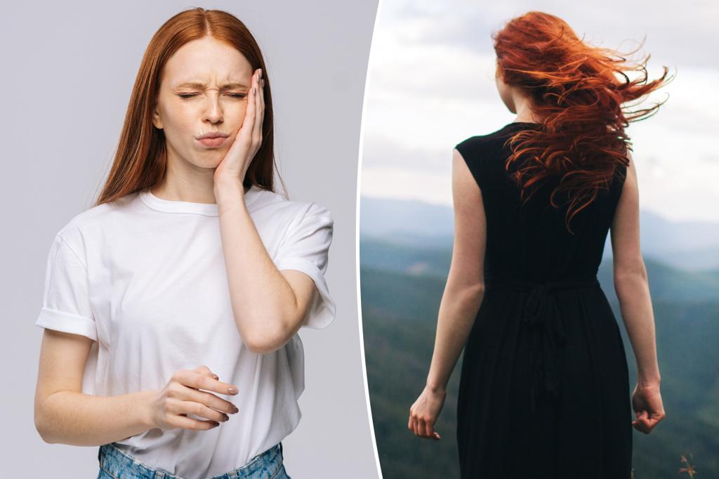 Scientists say that redheads feel pleasure and pain differently