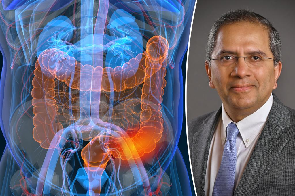 Colon surgeon: what you should always do to prevent colon cancer