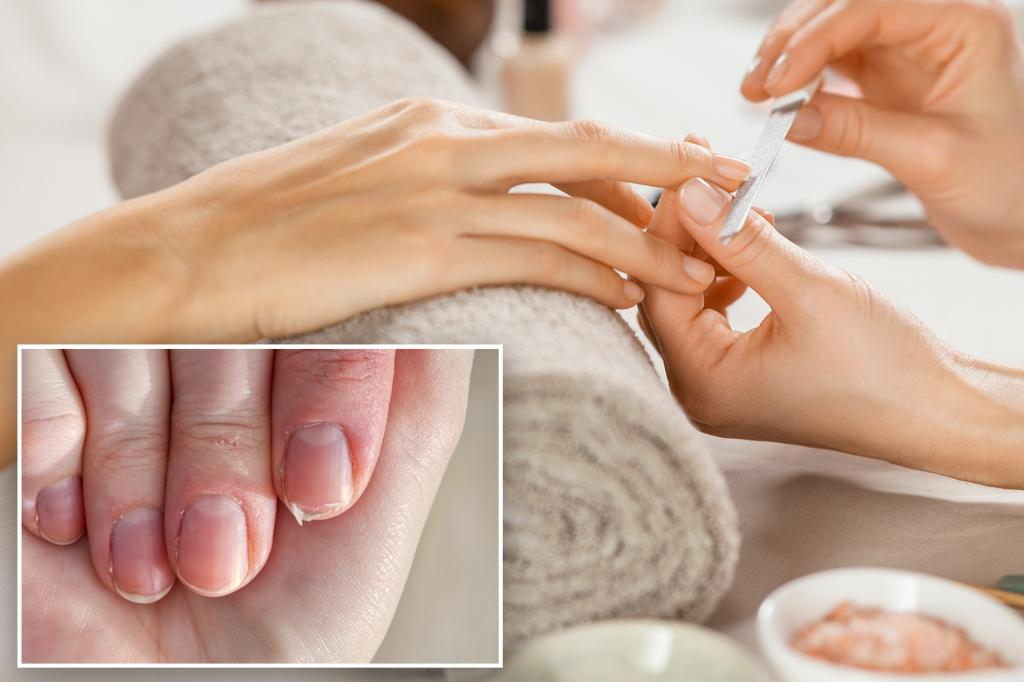 How to make your weak and brittle nails stronger