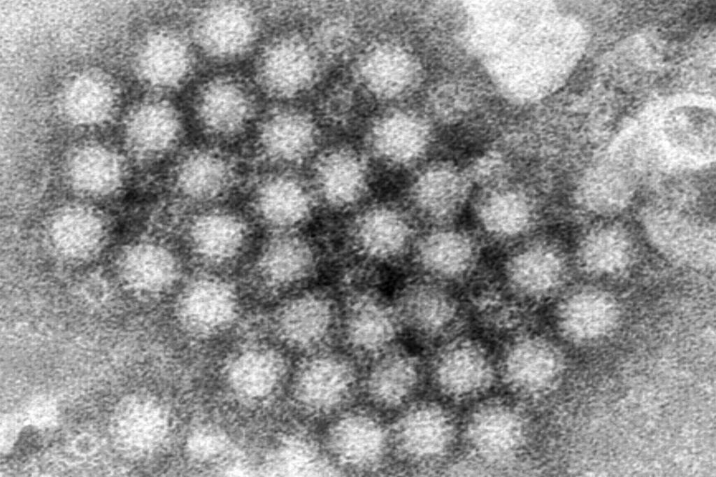 Norovirus cases are on the rise in parts of the US, CDC data show